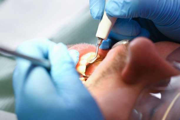 Best Emergency Dental Care for Broken or Chipped Teeth in Mauston, WI